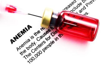 Iron Deficiency Anemia e vima