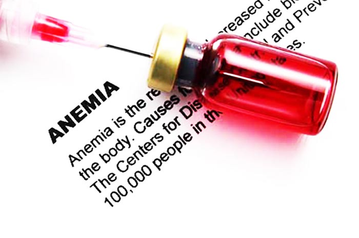 Iron Deficiency Anemia e vima