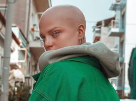 alopekia e vima