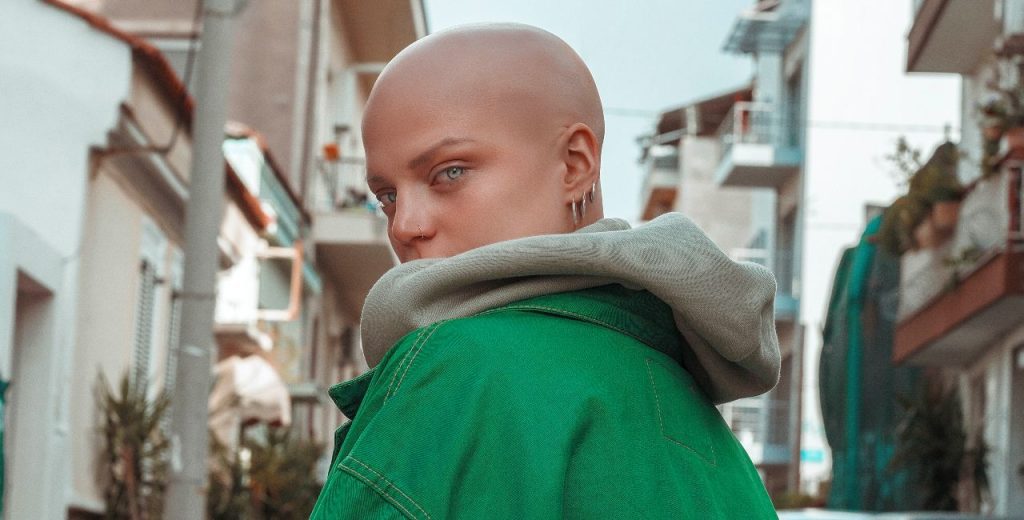 alopekia e vima