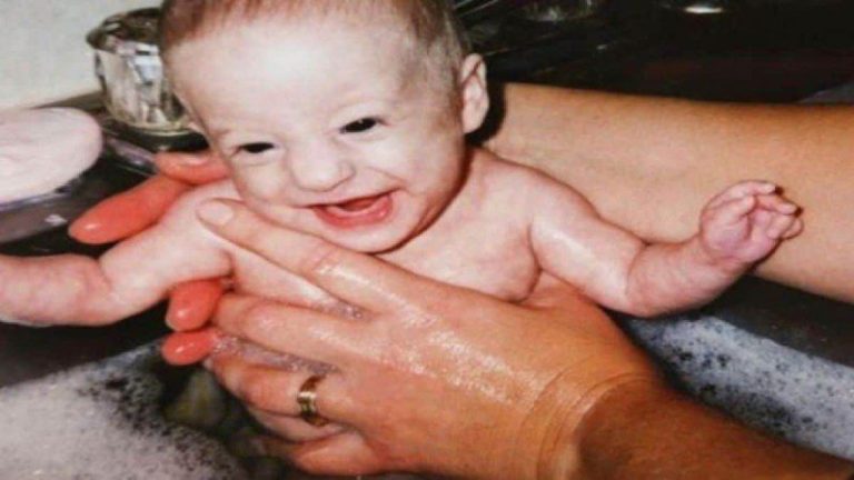 Μία μητέρα υιοθέτησε ένα μωράκι που κανείς δεν ήθελε – Πέρασαν 19 χρόνια και είναι αγνώριστο