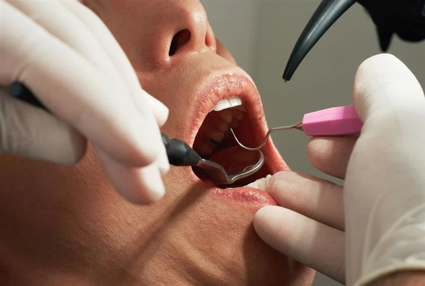 Γαλλία: Οδοντίατρος δεν αποστείρωνε τα εργαλεία – Τρέχουν για εξετάσεις AIDS και ηπατίτιδας